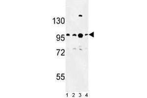 Western blot analysis of BCL11A antibody and 1) Jurkat, 2) Ramos, 3) 293 and 4)NCI-H460 lysate. (BCL11A Antikörper  (AA 806-835))