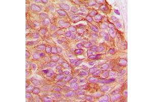 Immunohistochemistry (IHC) image for anti-Junction Plakoglobin (JUP) (C-Term) antibody (ABIN7296092)