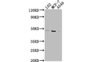 Western Blot Positive WB detected in: LO2 whole cell lysate, MCF-7 whole cell lysate, A549 whole cell lysate All lanes: USP17L6P antibody at 1:2000 Secondary Goat polyclonal to rabbit IgG at 1/50000 dilution Predicted band size: 45 kDa Observed band size: 45 kDa (USP17L6P Antikörper  (C-Term))
