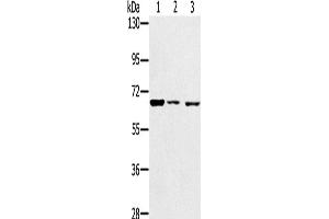 Western Blotting (WB) image for anti-Insulin-Like Growth Factor 2 mRNA Binding Protein 3 (IGF2BP3) antibody (ABIN2428265)
