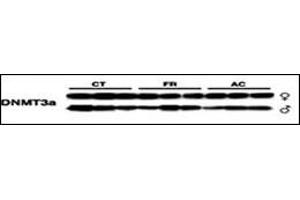 Western Blotting (WB) image for anti-DNA (Cytosine-5-)-Methyltransferase 3 alpha (DNMT3A) (AA 457-486) antibody (ABIN387881)