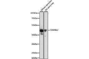 Western blot analysis of extracts of various cell lines, using SERPINI2 antibody (ABIN6131321, ABIN6147617, ABIN6147618 and ABIN6215429) at 1:1000 dilution. (SERPINI2 Antikörper  (AA 56-405))