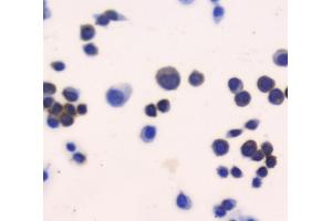 IHC analysis of Thioredoxin TRX using anti-Thioredoxin TRX antibody (ABIN6719381).