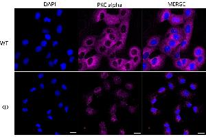 Immunocytochemical staining of HT- cells using PKC alpha antibody (ABIN7799989), 1:1,000), Top panel: wild-type (WT), Bottom panal: PKC alpha shRNA knockdown (KD).