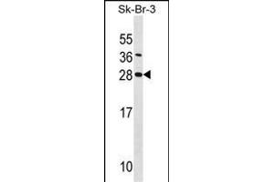SDC4 Antibody (Center) (ABIN1538722 and ABIN2848544) western blot analysis in SK-BR-3 cell line lysates (35 μg/lane). (SDC4 Antikörper  (AA 98-127))
