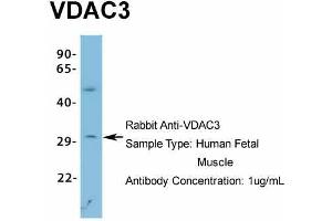 Host: Rabbit Target Name: VDAC3 Sample Type: Human Fetal Muscle Antibody Dilution: 1. (VDAC3 Antikörper  (N-Term))