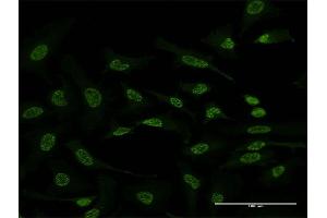 Immunofluorescence of monoclonal antibody to ATF2 on HeLa cell. (ATF2 Antikörper  (AA 91-190))