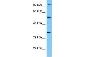 Host:  Mouse  Target Name:  TCF7L2  Sample Tissue:  Mouse Kidney  Antibody Dilution:  1ug/ml
