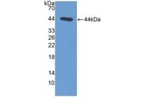 Detection of Recombinant NT-ProANP, Rat using Polyclonal Antibody to N-Terminal Pro-Atrial Natriuretic Peptide (NT-ProANP) (PRO-ANP Antikörper  (AA 25-122))