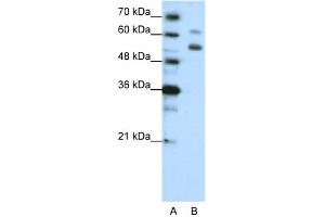 WB Suggested Anti-WDR4 Antibody Titration:  1. (WDR4 Antikörper  (C-Term))