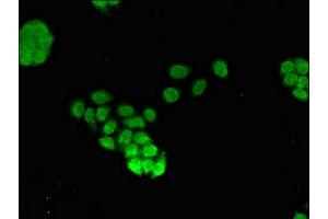Immunofluorescent analysis of PC-3 cells using ABIN7153101 at dilution of 1:100 and Alexa Fluor 488-congugated AffiniPure Goat Anti-Rabbit IgG(H+L) (FOXQ1 Antikörper  (AA 10-123))