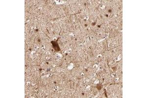 Immunohistochemical staining of human cerebral cortex with CLOCK polyclonal antibody  shows moderate nuclear positivity in neuronal cells.