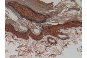 DAB staining on IHC-P; Samples: Rat Skin Tissue (CSTA Antikörper  (AA 1-103))