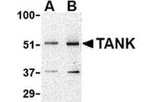 Western blot analysis of TANK in Daudi cell lysate with this product at (A) 0. (TANK Antikörper  (N-Term))