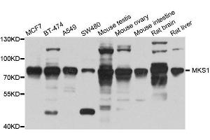 Western blot analysis of extracts of various cell lines, using MKS1 antibody. (MKS1 Antikörper  (AA 150-300))