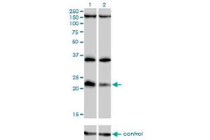 Western blot analysis of DUSP22 over-expressed 293 cell line, cotransfected with DUSP22 Validated Chimera RNAi (Lane 2) or non-transfected control (Lane 1). (DUSP22 Antikörper  (AA 112-184))