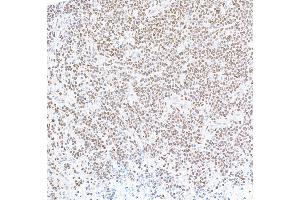 Immunohistochemistry (IHC) image for anti-Forkhead Box P1 (FOXP1) (AA 627-677) antibody (ABIN7454010)