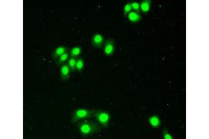 Figure:FITC staining on IHC-P Simple: Hela cells (XPO1 Antikörper  (AA 917-1071))