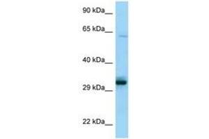 Image no. 1 for anti-Phosphopantothenoylcysteine Synthetase (PPCS) (C-Term) antibody (ABIN6748412) (PPCS Antikörper  (C-Term))