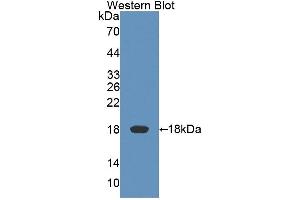 Detection of Recombinant KLRK1, Rat using Polyclonal Antibody to Killer Cell Lectin Like Receptor Subfamily K, Member 1 (KLRK1)