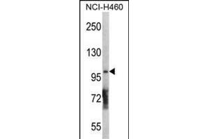 DGKQ Antibody  (ABIN392717 and ABIN2842188) western blot analysis in NCI- cell line lysates (35 μg/lane). (DGKQ Antikörper  (C-Term))