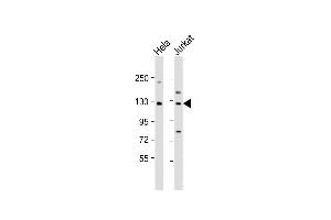 All lanes : Anti-DIS3 Antibody (Center) at 1:1000 dilution Lane 1: Hela whole cell lysate Lane 2: Jurkat whole cell lysate Lysates/proteins at 20 μg per lane. (DIS3 Antikörper  (AA 295-323))