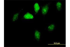 Immunofluorescence of purified MaxPab antibody to GNL1 on HeLa cell. (GNL1 Antikörper  (AA 1-607))