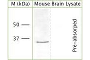 WB on mouse brain lysate (denatured, reduced) using Rabbit antibody to n-terminal region of OLIG2 (Oligo2, bHLHB1, RACK17): IgG (ABIN350657) at a concentration of 30 µg/ml. (OLIG2 Antikörper  (AA 80-130))