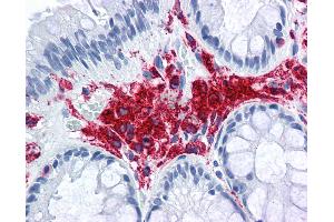 Anti-MHC Class II DQ DR Polymorphic antibody IHC of human colon. (MHC Class II DQ/DR Antikörper (FITC))