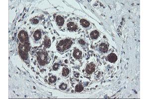 Image no. 3 for anti-NADH Dehydrogenase (Ubiquinone) 1 beta Subcomplex, 10, 22kDa (NDUFB10) antibody (ABIN1499668)