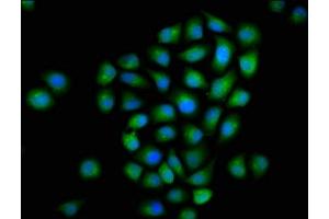 Immunofluorescence staining of Hela cells with ABIN7160643 at 1:133, counter-stained with DAPI. (MTMR2 Antikörper  (AA 1-173))