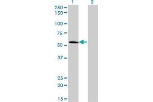 Western Blot analysis of ZNF622 expression in transfected 293T cell line by ZNF622 monoclonal antibody (M02), clone 3C5. (ZNF622 Antikörper  (AA 1-100))
