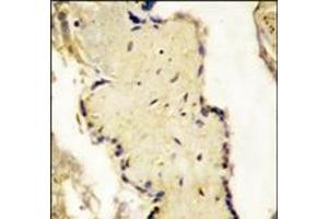 Formalin-fixed and paraffin-embedded placenta tissue reacted with SPPL2a Antibody (N-term), which was peroxidase-conjugated to the secondary antibody, followed by DAB staining. (SPPL2A Antikörper  (N-Term))