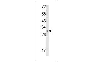 EBP Antikörper  (N-Term)