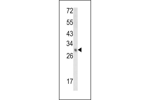 EBP Antikörper  (N-Term)