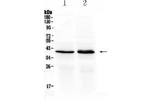 Western blot analysis of OTC using anti- OTC antibody .