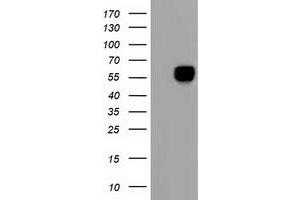 HEK293T cells were transfected with the pCMV6-ENTRY control (Left lane) or pCMV6-ENTRY AFP (Right lane) cDNA for 48 hrs and lysed. (alpha Fetoprotein Antikörper)