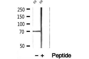Western blot analysis of extracts of A549 cells, using LGALS3BP antibody.