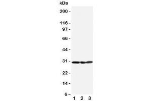 Western blot testing of COMT antibody and Lane 1:  HeLa;  2: A375;  3: PANC cell lysate.