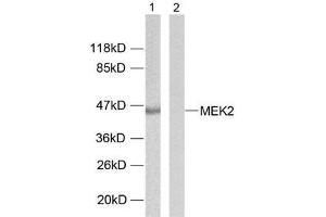 Western blot analysis of extracts from ovary cancer cells using MEK2 (Ab-394) antibody (E021008). (MEK2 Antikörper)