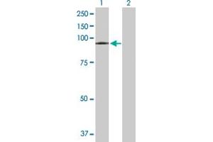 Western Blotting (WB) image for anti-Vacuolar Protein Sorting-Associated Protein 16 Homolog (VPS16) (AA 1-839) antibody (ABIN528673)