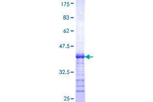 SLC12A6 Protein (AA 1-90) (GST tag)