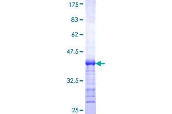 SLC12A6 Protein (AA 1-90) (GST tag)