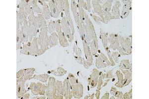 Immunohistochemistry of paraffin-embedded Mouse heart using FGF2 Polyclonal Antibody at dilution of 1:100 (40x lens). (FGF2 Antikörper)