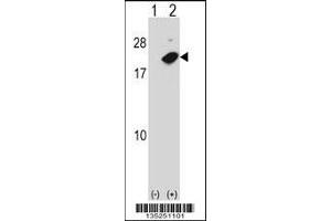 Western Blotting (WB) image for anti-Nudix (Nucleoside Diphosphate Linked Moiety X)-Type Motif 2 (NUDT2) (AA 62-90) antibody (ABIN5534203)