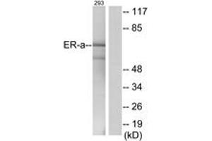 Western blot analysis of extracts from 293 cells, using Estrogen Receptor-alpha (Ab-537) Antibody. (Estrogen Receptor alpha Antikörper  (AA 501-550))