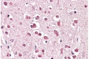 Image no. 1 for anti-XPA Binding Protein 2 (XAB2) (C-Term) antibody (ABIN374084) (XAB2 Antikörper  (C-Term))