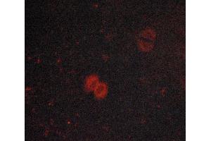 Immunofluorescence (fixed cells) (IF/ICC) image for anti-Janus Kinase 1 (JAK1) (pTyr1022), (pTyr1023) antibody (ABIN6255762)