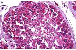 Human Testis: Formalin-Fixed, Paraffin-Embedded (FFPE) (PDK2 Antikörper  (AA 187-276))