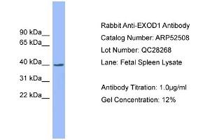 WB Suggested Anti-EXOD1  Antibody Titration: 0. (ERI2 Antikörper  (N-Term))